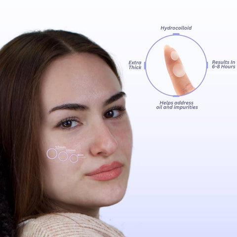 Hydrocolloid Acne Patches – Overnight Blemish Treatment